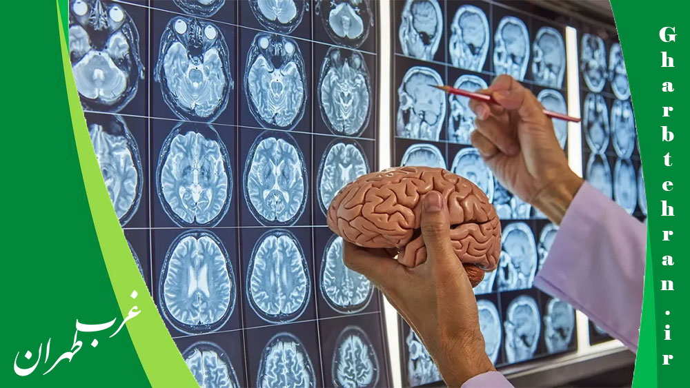 10 تا از برترین پزشک جراح و متخصص مغز و اعصاب در کرج⭐ [سال 1404]، غرب تهران